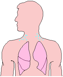 subcutaneous emphysema