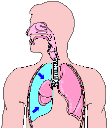 pneumothorax